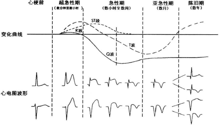 平滑重启_特征异常平滑