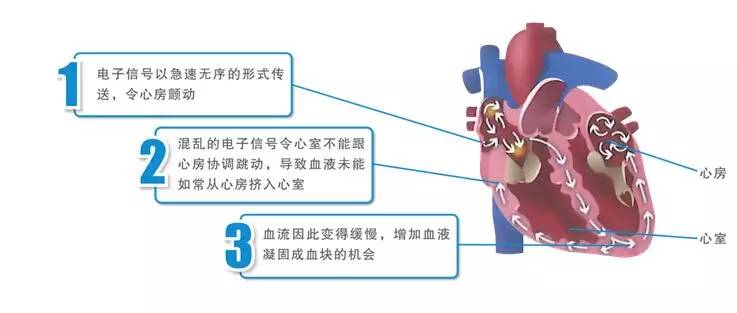 mapreduce 心跳机制_检查心跳健康